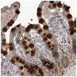 GOLPH3L, Rabbit, Polyclonal Antibody, Abnova 100 &mu;L | Buy Online | Abnova Corporation | Fisher Scientific