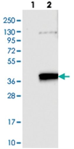 GOLPH3L, Rabbit, Polyclonal Antibody, Abnova 100 &mu;L | Buy Online | Abnova Corporation | Fisher Scientific
