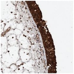 KIF26B Rabbit anti-Human, Polyclonal Antibody, Abnova 100 &mu;L | Buy Online | Abnova Corporation | Fisher Scientific