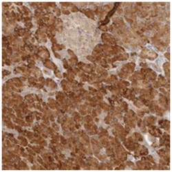 UBXN10 Rabbit anti-Human, Polyclonal Antibody, Abnova 100&mu;L; Unlabeled:Anticuerpos