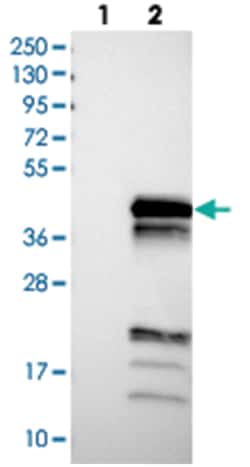 UBXN10 Rabbit anti-Human, Polyclonal Antibody, Abnova 100&mu;L; Unlabeled:Anticuerpos
