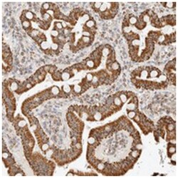 LYPD2, Rabbit, Polyclonal Antibody, Abnova 100 &mu;L | Buy Online | Abnova Corporation | Fisher Scientific