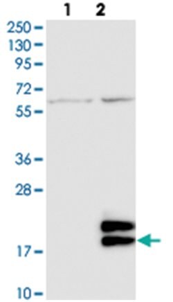 LYPD2, Rabbit, Polyclonal Antibody, Abnova 100 &mu;L | Buy Online | Abnova Corporation | Fisher Scientific