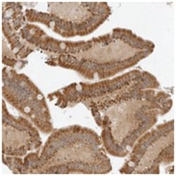IQCC Rabbit anti-Human, Polyclonal Antibody, Abnova 100 &mu;L | Buy Online | Abnova Corporation | Fisher Scientific