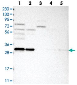 GEMIN8, Rabbit, Polyclonal Antibody, Abnova 100&mu;L; Unlabeled:Antibodies,
