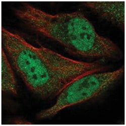 GEMIN8, Rabbit, Polyclonal Antibody, Abnova 100&mu;L; Unlabeled:Antibodies,