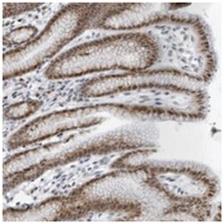 PPP1R42 Rabbit anti-Human, Polyclonal Antibody, Abnova 100&mu;L; Unlabeled:Antibodies,