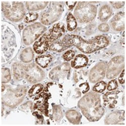 C1orf172 Rabbit anti-Human, Polyclonal Antibody, Abnova 100 &mu;L | Buy Online | Abnova Corporation | Fisher Scientific