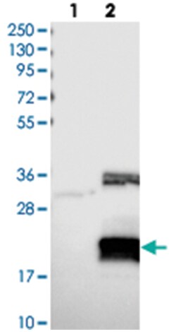 CHTOP, Rabbit, Polyclonal Antibody, Abnova 100&mu;L; Unlabeled:Antibodies,