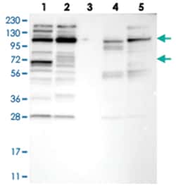 CHD1L Rabbit anti-Human, Polyclonal Antibody, Abnova 100 &mu;L | Buy Online | Abnova Corporation | Fisher Scientific