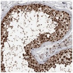 CHD1L Rabbit anti-Human, Polyclonal Antibody, Abnova 100 &mu;L | Buy Online | Abnova Corporation | Fisher Scientific