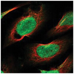 CHD1L Rabbit anti-Human, Polyclonal Antibody, Abnova 100 &mu;L | Buy Online | Abnova Corporation | Fisher Scientific