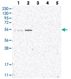 IQCC Rabbit anti-Human, Polyclonal Antibody, Abnova 100 &mu;L | Buy Online | Abnova Corporation | Fisher Scientific
