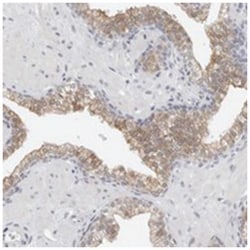 FLG2, Rabbit, Polyclonal Antibody, Abnova 100&mu;L; Unlabeled:Antibodies,
