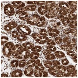 SEC14L1, Rabbit, Polyclonal Antibody, Abnova 100 &mu;L | Buy Online | Abnova Corporation | Fisher Scientific