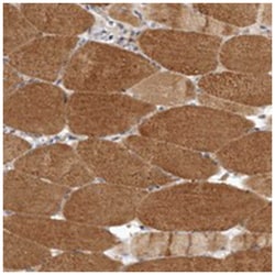 LRP5L, Rabbit, Polyclonal Antibody, Abnova 100&mu;L; Unlabeled:Antibodies,