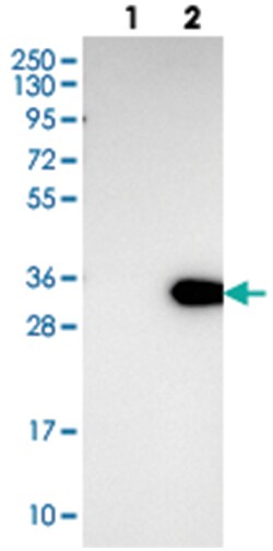 LRP5L, Rabbit, Polyclonal Antibody, Abnova 100&mu;L; Unlabeled:Antibodies,