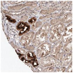 SLC12A3 Rabbit anti-Human, Polyclonal Antibody, Abnova 100&mu;L; Unlabeled:Antibodies,