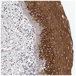 ACLY Rabbit anti-Human, Mouse, Rat, Polyclonal Antibody, Abnova 100&mu;L;