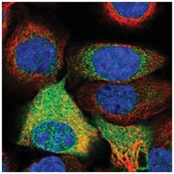 ACLY Rabbit anti-Human, Mouse, Rat, Polyclonal Antibody, Abnova 100&mu;L;