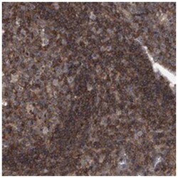 PAN3, Rabbit, Polyclonal Antibody, Abnova 100&mu;L; Unlabeled:Antibodies,