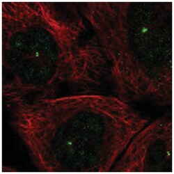 PAN3, Rabbit, Polyclonal Antibody, Abnova 100&mu;L; Unlabeled:Antibodies,