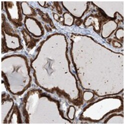 OR4K1, Rabbit, Polyclonal Antibody, Abnova 100&mu;L; Unlabeled:Antibodies,