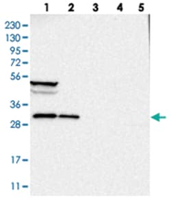SBDS, Rabbit, Polyclonal Antibody, Abnova 100&mu;L; Unlabeled:Antibodies,
