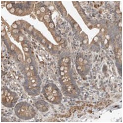 SLC6A7, Rabbit, Polyclonal Antibody, Abnova 100 &mu;L | Buy Online | Abnova Corporation | Fisher Scientific