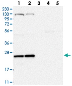 ARL4C, Rabbit, Polyclonal Antibody, Abnova 100&mu;L; Unlabeled:Antibodies,
