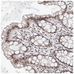 SRCAP, Rabbit, Polyclonal Antibody, Abnova 100 &mu;L | Buy Online | Abnova Corporation | Fisher Scientific