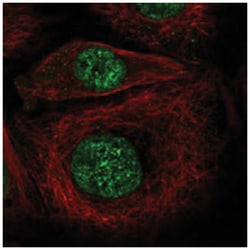 TAF4B, Rabbit, Polyclonal Antibody, Abnova 100&mu;L; Unlabeled:Antibodies,