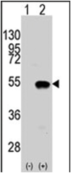 SMYD2, Rabbit, Polyclonal Antibody, Abnova 400 &mu;L | Buy Online | Abnova Corporation | Fisher Scientific