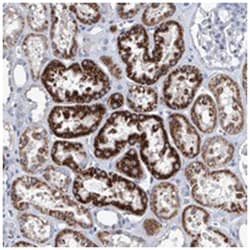 ZNF519, Rabbit, Polyclonal Antibody, Abnova 100 &mu;L | Buy Online | Abnova Corporation | Fisher Scientific