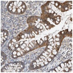 PHACTR4, Rabbit, Polyclonal Antibody, Abnova 100 &mu;L | Buy Online | Abnova | Fisher Scientific