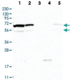 CPSF3L Rabbit anti-Human, Mouse, Rat, Polyclonal Antibody, Abnova 100&mu;L;