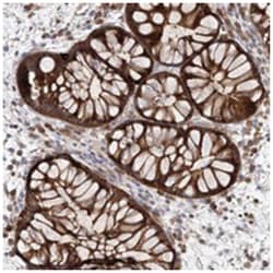 LRRC16A Rabbit anti-Human, Polyclonal Antibody, Abnova 100&mu;L; Unlabeled:Antibodies,