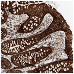 LRRC16A Rabbit anti-Human, Polyclonal Antibody, Abnova 100&mu;L; Unlabeled:Antibodies,