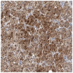 BPTF, Rabbit, Polyclonal Antibody, Abnova 100&mu;L; Unlabeled:Antibodies,
