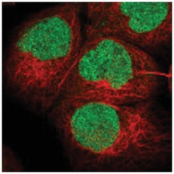 BPTF, Rabbit, Polyclonal Antibody, Abnova 100&mu;L; Unlabeled:Antibodies,
