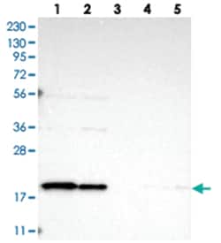TIMM17B, Rabbit, Polyclonal Antibody, Abnova 100 &mu;L | Buy Online | Abnova Corporation | Fisher Scientific