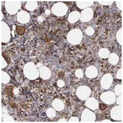 TIMM17B, Rabbit, Polyclonal Antibody, Abnova 100 &mu;L | Buy Online | Abnova Corporation | Fisher Scientific