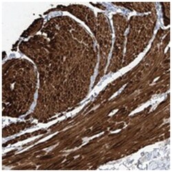 C1orf85, Rabbit, Polyclonal Antibody, Abnova 100&mu;L; Unlabeled:Antibodies,