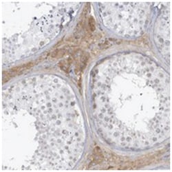 HSD17B13, Rabbit, Polyclonal Antibody, Abnova 100&mu;L; Unlabeled:Antibodies,