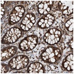 CEP85L Rabbit anti-Human, Polyclonal Antibody, Abnova 100 &mu;L | Buy Online | Abnova Corporation | Fisher Scientific