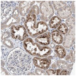 CEP85L Rabbit anti-Human, Polyclonal Antibody, Abnova 100 &mu;L | Buy Online | Abnova Corporation | Fisher Scientific