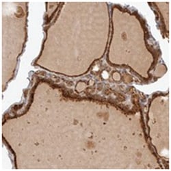 ZRANB1 Rabbit anti-Human, Polyclonal Antibody, Abnova 100 &mu;L | Buy Online | Abnova Corporation | Fisher Scientific