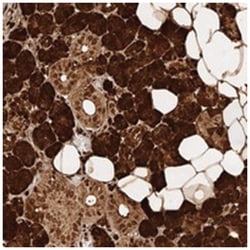 KIAA2018 Rabbit anti-Human, Polyclonal Antibody, Abnova 100 &mu;L | Buy Online | Abnova Corporation | Fisher Scientific