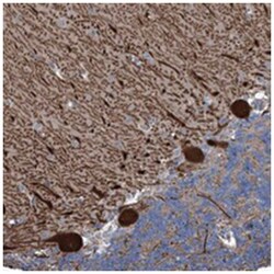 KIF13A Rabbit anti-Human, Polyclonal Antibody, Abnova 100 &mu;L | Buy Online | Abnova Corporation | Fisher Scientific