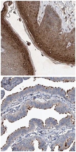 KIAA1751 Rabbit anti-Human, Polyclonal Antibody, Abnova 100 &mu;L | Buy Online | Abnova Corporation | Fisher Scientific